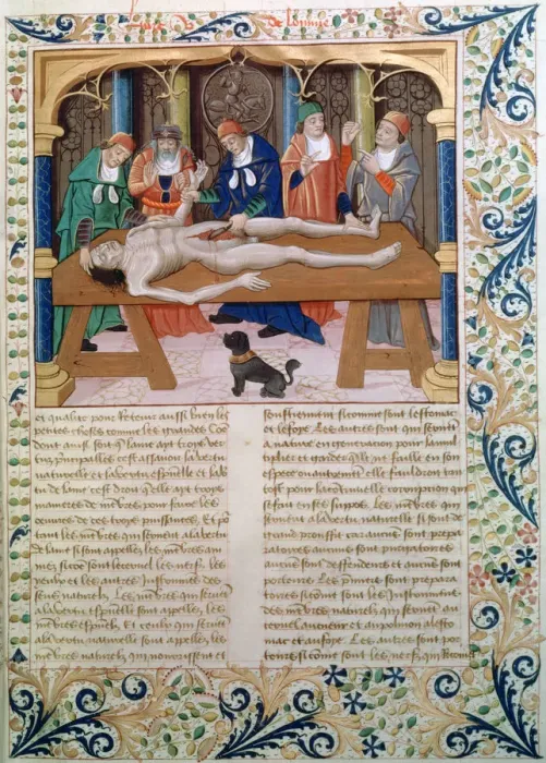 Framed Print : Dissection, late 15th century Framed Print : Dissection, late 15th century