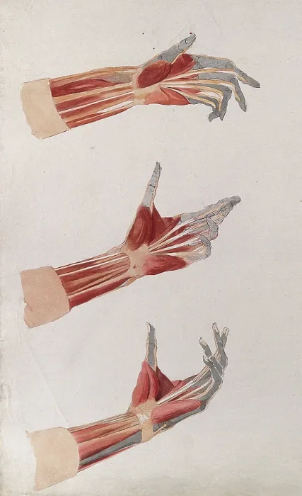 Framed Print : Three dissections of the left hand and wrist, showing the muscles and tendons, (1833?). Creator: Johann Conrad Zeller Framed Print : Three dissections of the left hand and wrist, showing the muscles and tendons, (1833?). Creator: Johann Conrad Zeller