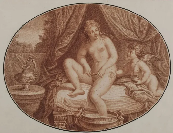 Framed Print : Epilation, 18th century. Creator: Anonymous Framed Print : Epilation, 18th century. Creator: Anonymous