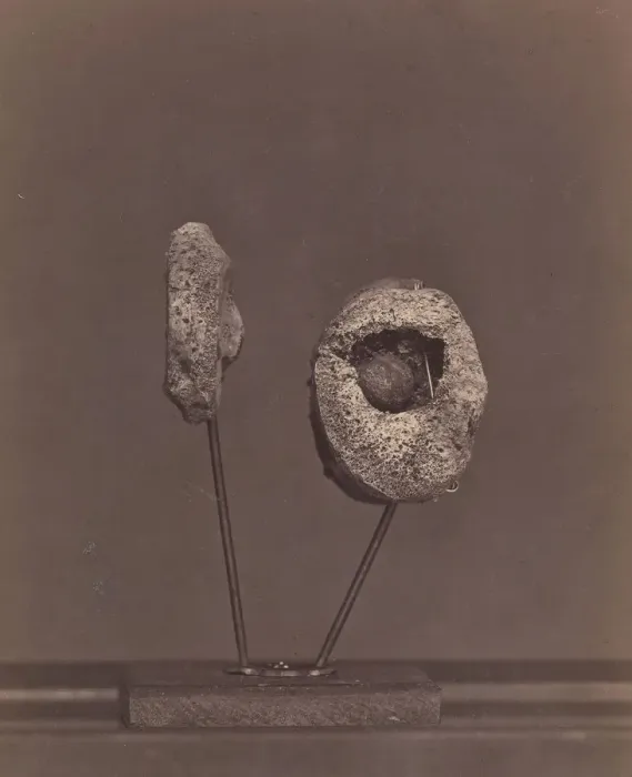 Framed Print : Excised Knee Joint. A Round Musket Ball in the Inner Condyle of the Right Femur [Gardin Framed Print : Excised Knee Joint. A Round Musket Ball in the Inner Condyle of the Right Femur [Gardin