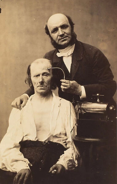 Faradisation du muscle frontal, 1854-56, printed 1862. Creators: Duchenne de Boulogne