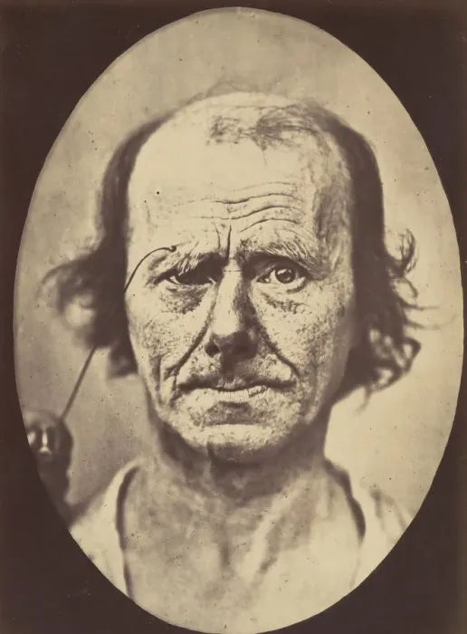 Framed Print : Figure 12: A study of the contraction of and the expression produced by t Framed Print : Figure 12: A study of the contraction of and the expression produced by t