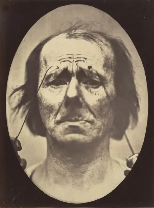 Framed Print : Figure 20: Profound suffering, with resignation, 1854-56, printed 1862 Framed Print : Figure 20: Profound suffering, with resignation, 1854-56, printed 1862