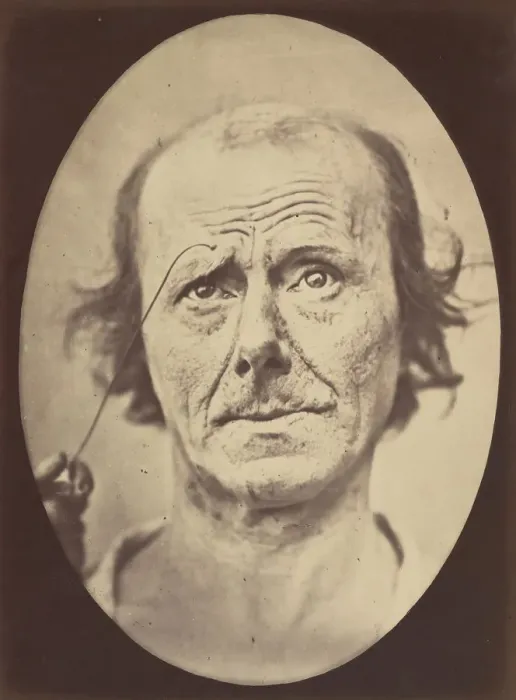 Framed Print : Figure 21: Painful recollection and recollection or calling something to Framed Print : Figure 21: Painful recollection and recollection or calling something to