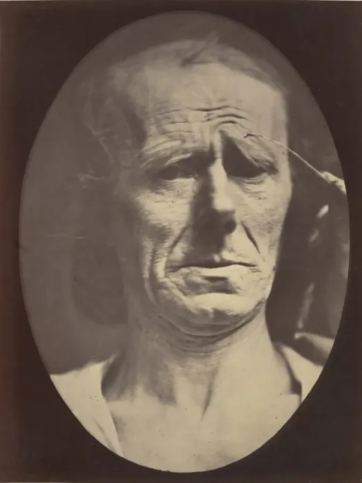 Framed Print : Figure 22: No painful expression, 1854-56, printed 1862 Framed Print : Figure 22: No painful expression, 1854-56, printed 1862