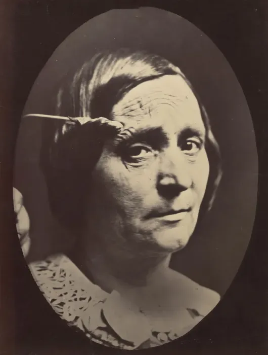 Framed Print : Figure 26: Expression of painful attention and attention, attentive gaze