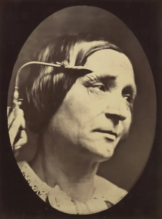 Framed Print : Figure 27: Expression proportionally more pained, 1854-56, printed 1862 Framed Print : Figure 27: Expression proportionally more pained, 1854-56, printed 1862