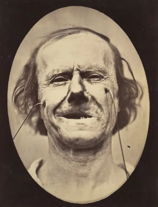 Framed Print : Figure 48: Mild weeping, pity and feeble false laughter, 1854-56, printed 1862 Framed Print : Figure 48: Mild weeping, pity and feeble false laughter, 1854-56, printed 1862