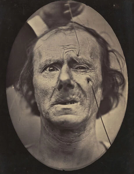 Figure 49: Painful weeping and forward looking. 1854-56, printed 1862