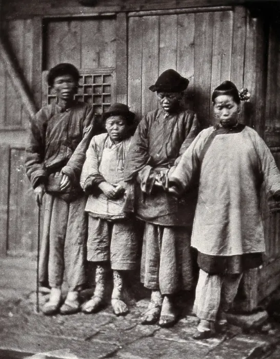 Framed Print : Foochow, China: four people with leprosy, wearing thick clothing, standing outside a wooden... 1873 Creator: John Thomson Framed Print : Foochow, China: four people with leprosy, wearing thick clothing, standing outside a wooden... 1873 Creator: John Thomson
