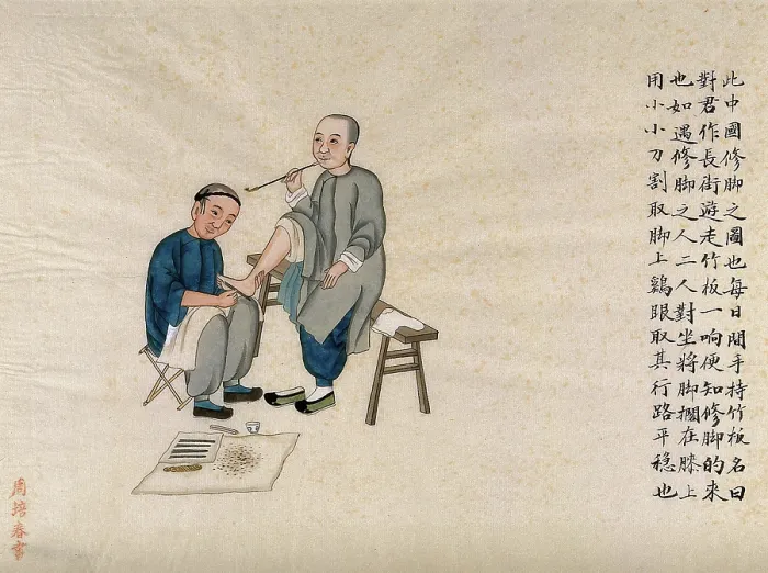 Framed Print : A foot doctor at work: the male patient is seated on a bench and smoking a pipe, 1890. Creator: Pei Qun Zhou Framed Print : A foot doctor at work: the male patient is seated on a bench and smoking a pipe, 1890. Creator: Pei Qun Zhou