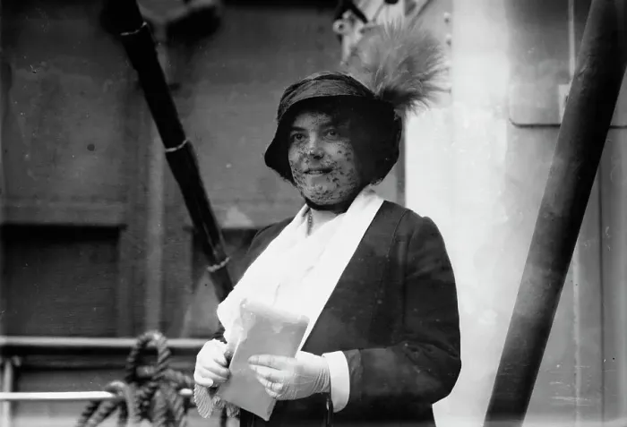 Framed Print : Frances Alda, 1913. Creator: Bain News Service Framed Print : Frances Alda, 1913. Creator: Bain News Service