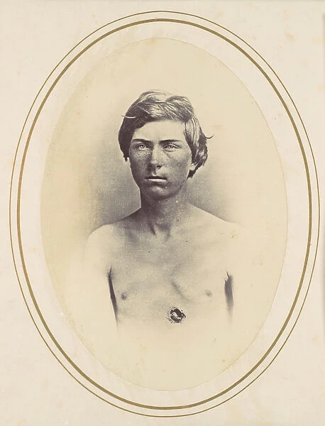 Frederick A. Bentley, 1865. Creator: Reed Brockway Bontecou
