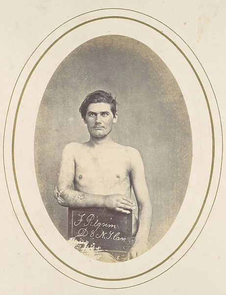 Frederick Pilgrim, 1865. Creator: Reed Brockway Bontecou