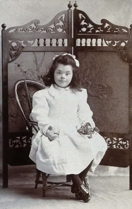 Framed Print : A girl with Down's syndrome, sitting in front of an ornate wooden screen... c1870s Framed Print : A girl with Down's syndrome, sitting in front of an ornate wooden screen... c1870s