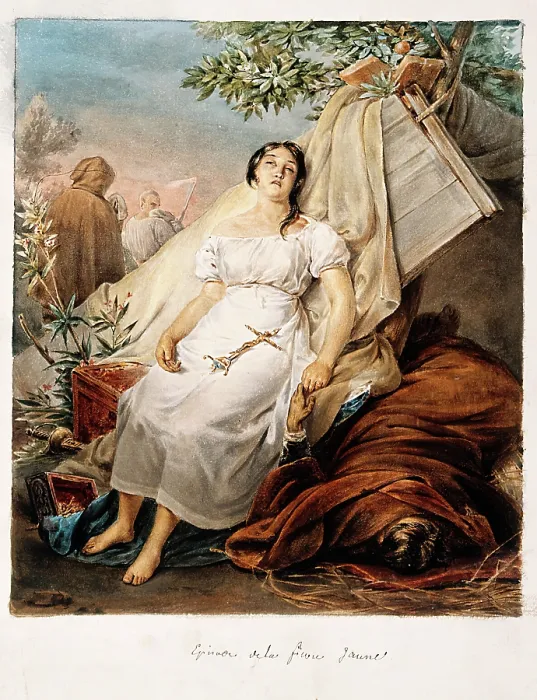 Framed Print : A girl suffering from yellow fever. Creator: Unknown Framed Print : A girl suffering from yellow fever. Creator: Unknown