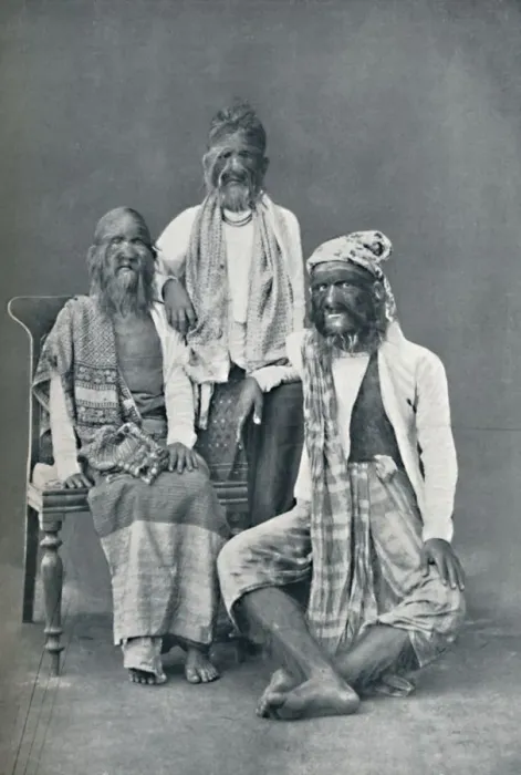 Framed Print : A hairy family of Mandalay, Burma, 1902. Artist: Bourne & Shepherd Framed Print : A hairy family of Mandalay, Burma, 1902. Artist: Bourne & Shepherd
