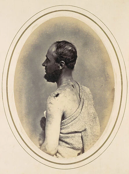 Henry Yon, 1865. Creator: Reed Brockway Bontecou