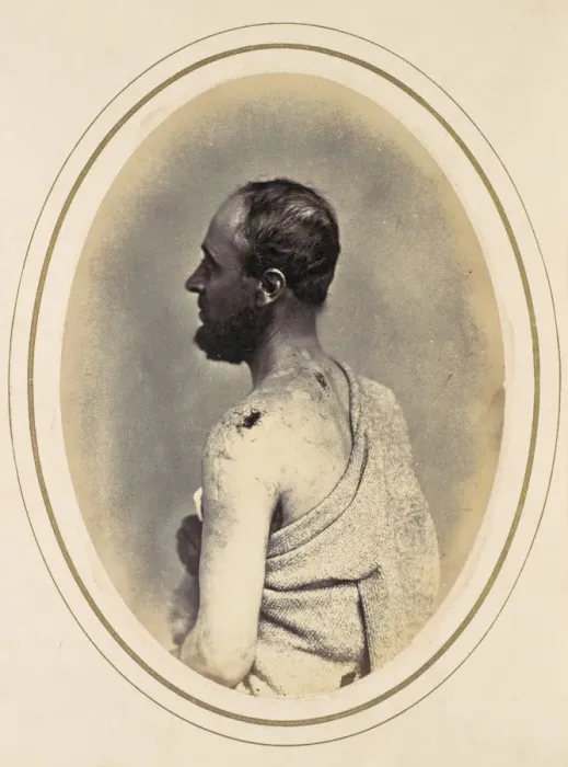 Framed Print : Henry Yon, 1865. Creator: Reed Brockway Bontecou Framed Print : Henry Yon, 1865. Creator: Reed Brockway Bontecou