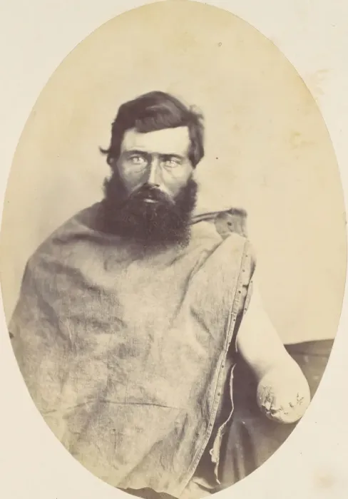 Framed Print : Herman Rice, 1865. Creator: Reed Brockway Bontecou Framed Print : Herman Rice, 1865. Creator: Reed Brockway Bontecou