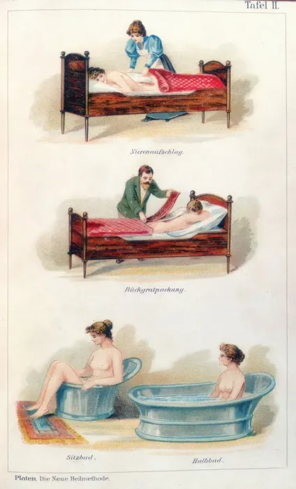 Framed Print : Hydrotherapy treatments, c1902 Framed Print : Hydrotherapy treatments, c1902