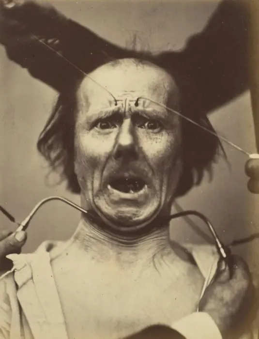 Framed Print : Icono-photographique. Mecanisme de la Physionomie Humaine. Fig