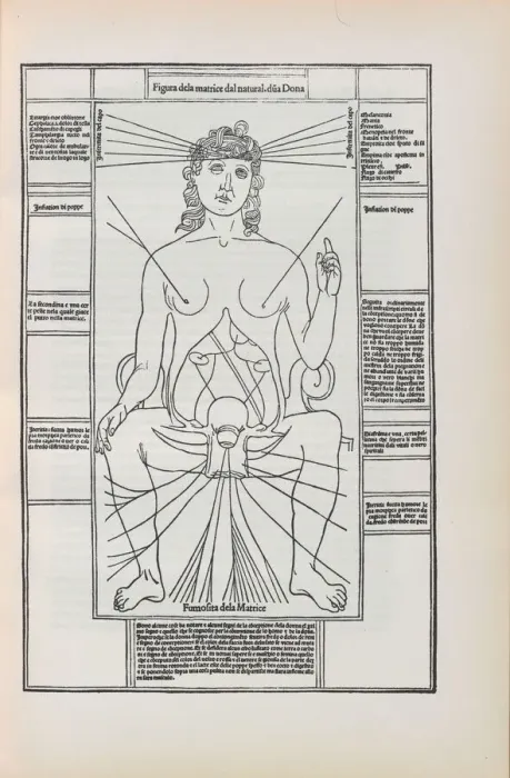 Framed Print : Illustration from Fasciculo di medicina'by Johannes de Ketham, 1493 Framed Print : Illustration from Fasciculo di medicina'by Johannes de Ketham, 1493