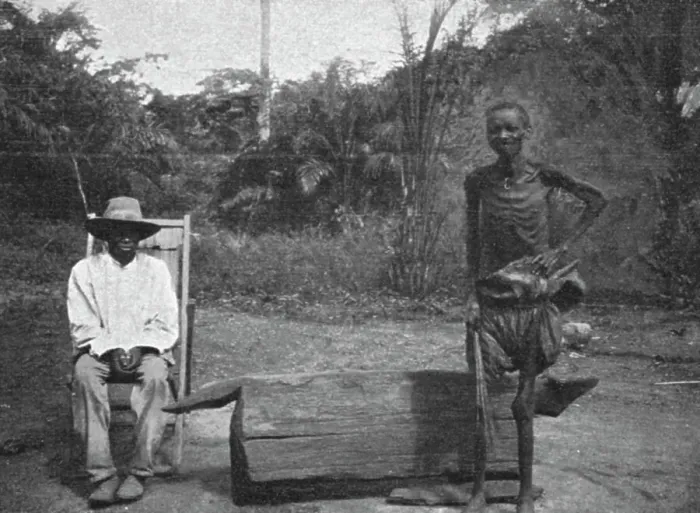 Framed Print : Indigene du Congo atteint de la maladie du sommeil; L'Ouest Africain, 1914. Creator: Unknown Framed Print : Indigene du Congo atteint de la maladie du sommeil; L'Ouest Africain, 1914. Creator: Unknown