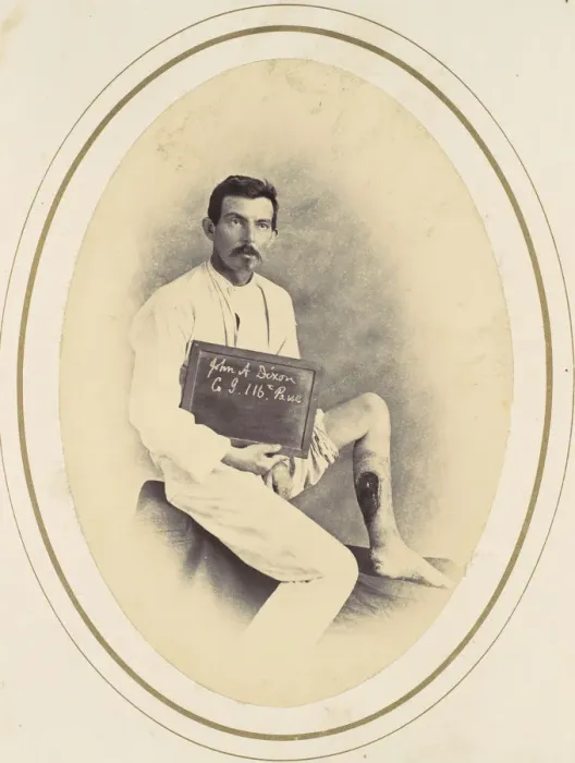 Framed Print : John A. Dixon, 1865. Creator: Reed Brockway Bontecou Framed Print : John A. Dixon, 1865. Creator: Reed Brockway Bontecou
