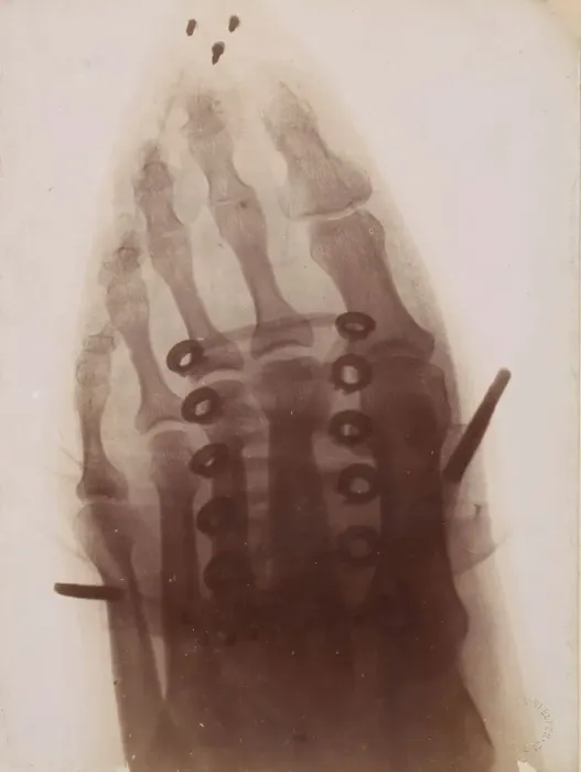 Framed Print : Le pied a travers la chaussure, 1896. Creator: Henri van Heurck Framed Print : Le pied a travers la chaussure, 1896. Creator: Henri van Heurck