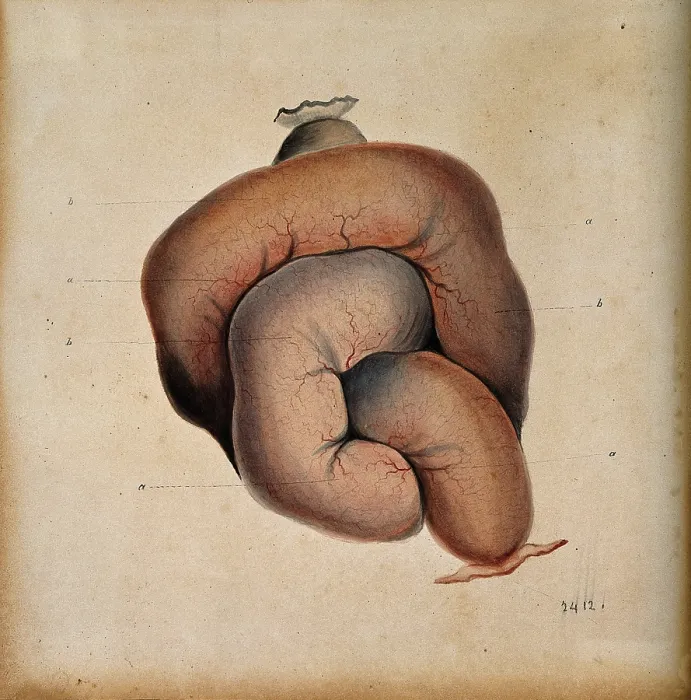 Framed Print : A length of coiled intestine, 1800-1899. Creator: Unknown Framed Print : A length of coiled intestine, 1800-1899. Creator: Unknown