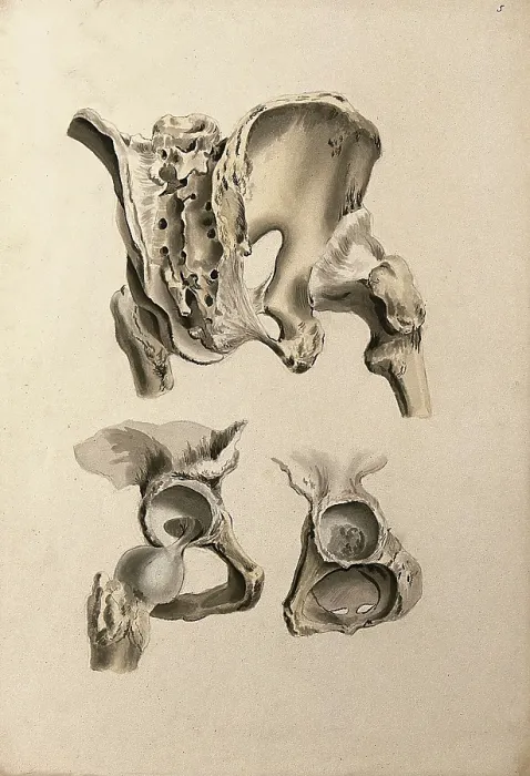 Framed Print : Ligaments of hip-bone and femur (thigh-bone), 1830-1835. Creator: Unknown Framed Print : Ligaments of hip-bone and femur (thigh-bone), 1830-1835. Creator: Unknown