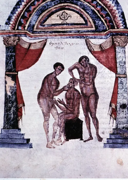 Framed Print : Mandibular reduction, miniature in the Surgery Codex in Comments of Apollonius, by