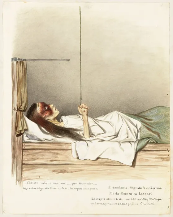 Framed Print : Maria Domenica Lazzari (Lazzeri), a girl with stigmata on her hands, c1840. Creator: Louis Gaston Adrien de Segur Framed Print : Maria Domenica Lazzari (Lazzeri), a girl with stigmata on her hands, c1840. Creator: Louis Gaston Adrien de Segur
