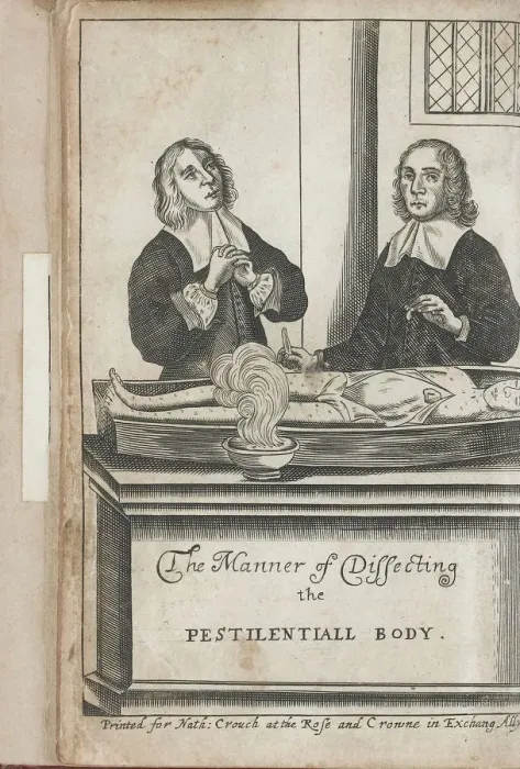 Framed Print : Two men dissecting a body with plague marks, 1666 Framed Print : Two men dissecting a body with plague marks, 1666