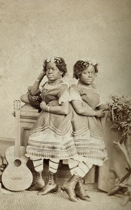 Framed Print : The Millie-Christine sisters, conjoined twins, standing, c1871. Creator: Unknown Framed Print : The Millie-Christine sisters, conjoined twins, standing, c1871. Creator: Unknown