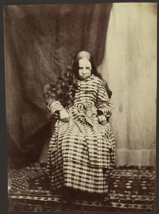 Framed Print : Portrait of a Female Patient, Surrey County Asylum, 1848-1858. Creator: Hugh Welch Diamond
