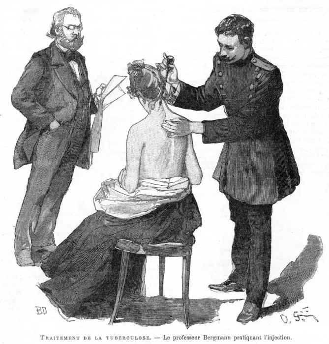 Framed Print : Professor Bergmann injecting a tuberculosis patient, 1891