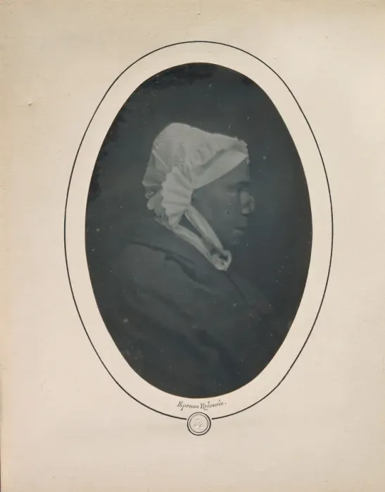 Framed Print : [Profile of a Woman with Necrosis of the Nose], 1841-48. Creator: Louis-Auguste Bisson