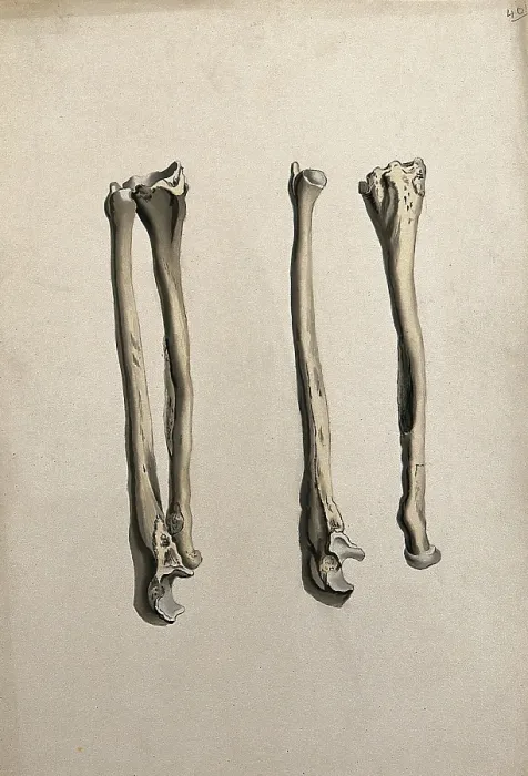 Framed Print : Radius and ulna bones: two figures, 1830-1835. Creator: Unknown Framed Print : Radius and ulna bones: two figures, 1830-1835. Creator: Unknown