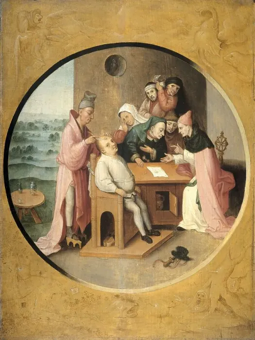 Framed Print : Removing the Rocks in the Head, c.1550-c.1600. Creator: Unknown
