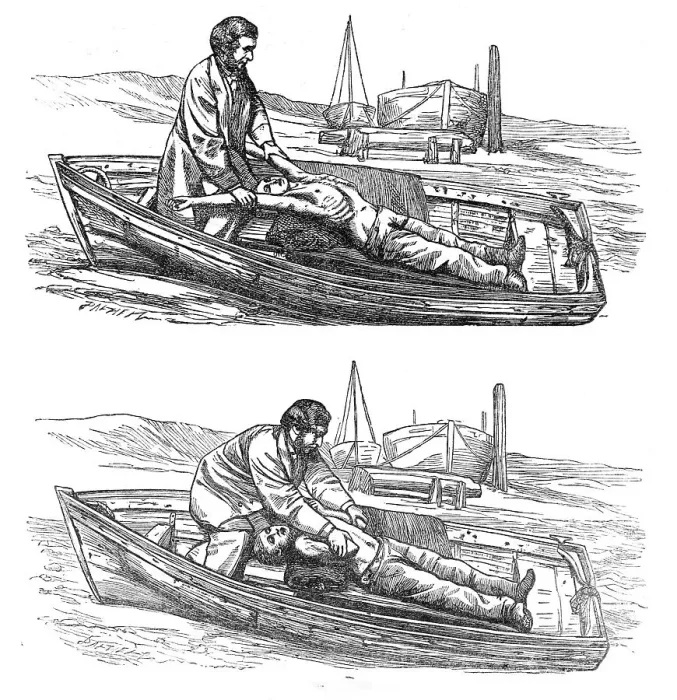 Framed Print : Restorative treatment of the apparently drowned:Silvester's method of inducing respiration, 1864. Creator: Dalziel Brothers Framed Print : Restorative treatment of the apparently drowned:Silvester's method of inducing respiration, 1864. Creator: Dalziel Brothers