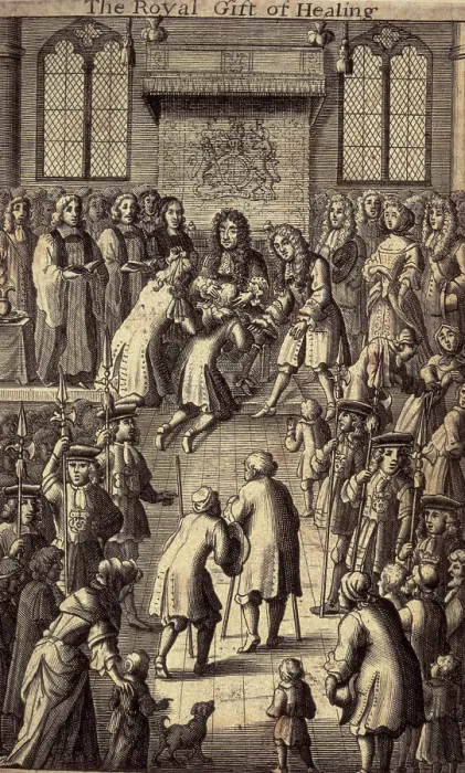 Framed Print : The Royal Gift of Healing, King Charles II healing the sick, 1684. Creator: Unknown. The Royal Gift of Healing, King Charles II healing the sick, 1684 Framed Print : The Royal Gift of Healing, King Charles II healing the sick, 1684. Creator: Unknown. The Royal Gift of Healing, King Charles II healing the sick, 1684