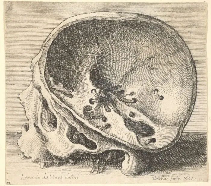 Framed Print : Sectioned skull in profile to left with the left side of the cranium removed, 1651 Framed Print : Sectioned skull in profile to left with the left side of the cranium removed, 1651