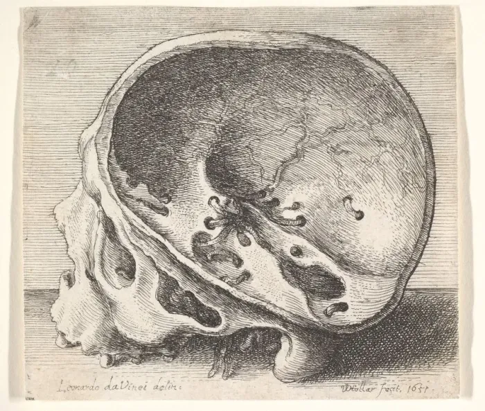 Framed Print : Sectioned skull in profile to left with the left side of the cranium removed, 1651 Framed Print : Sectioned skull in profile to left with the left side of the cranium removed, 1651
