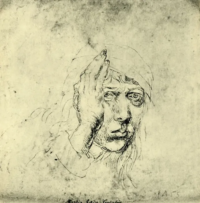 Framed Print : Self portrait with a Bandage, 1492, (1943). Creator: Albrecht Durer Framed Print : Self portrait with a Bandage, 1492, (1943). Creator: Albrecht Durer