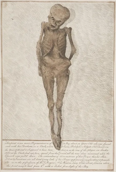 Framed Print : Skeleton of boy found in the vault at St Botolph, Aldgate, London, 1742 Framed Print : Skeleton of boy found in the vault at St Botolph, Aldgate, London, 1742