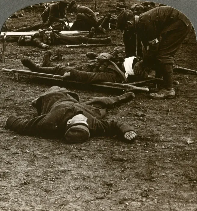 Framed Print : After the storm and stress of battle, caring for the wounded, World War I, 1914-1918. Artist: Realistic Travels Publishers Framed Print : After the storm and stress of battle, caring for the wounded, World War I, 1914-1918. Artist: Realistic Travels Publishers