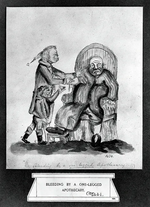 Framed Print : A surgeon-apothecary bleeding a patient, his servant boy catches the drops. Creator: Unknown Framed Print : A surgeon-apothecary bleeding a patient, his servant boy catches the drops. Creator: Unknown