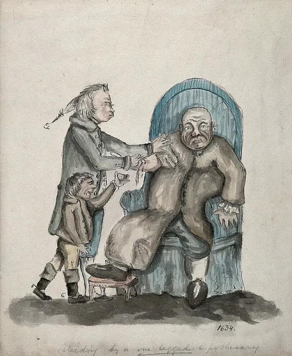 Framed Print : A surgeon-apothecary bleeding a patient, his servant boy catches the drops. Creator: Unknown Framed Print : A surgeon-apothecary bleeding a patient, his servant boy catches the drops. Creator: Unknown